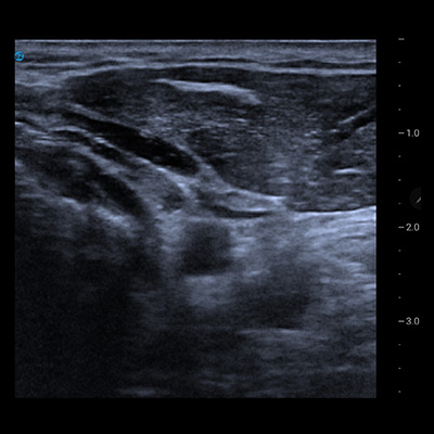 Ultra Sound image